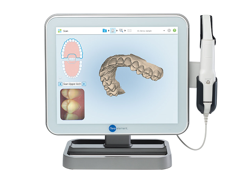 口腔内スキャナー