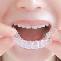 マウスピース矯正